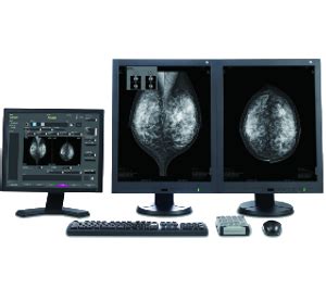 Clinical Applications – Fujifilm Women's Health.